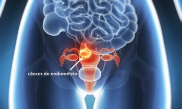 Câncer do endométrio