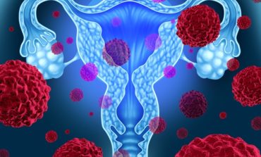 Endometriose e Câncer